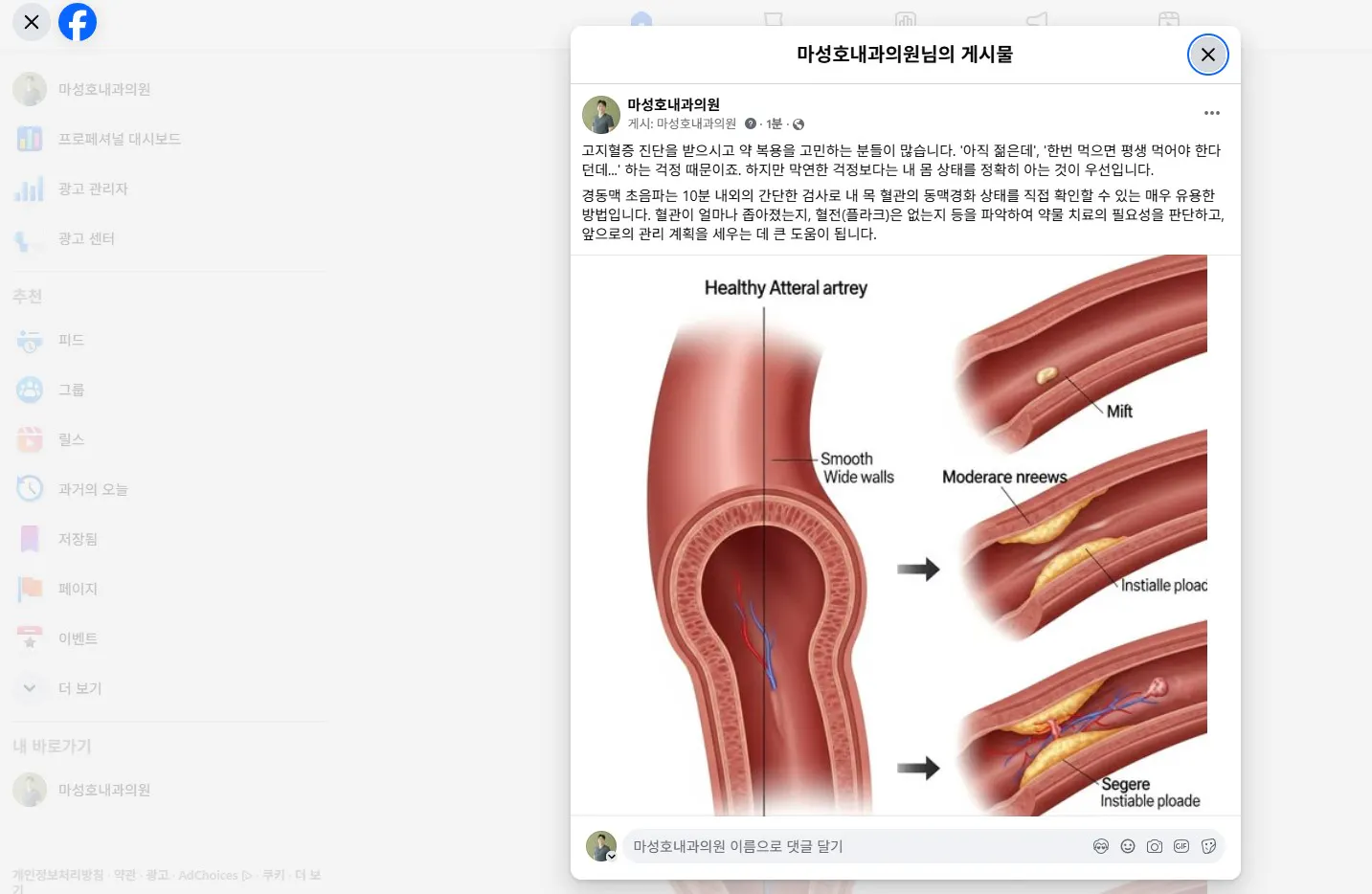 혈관 다이어그램을 보여주는 페이스북 페이지의 스크린샷