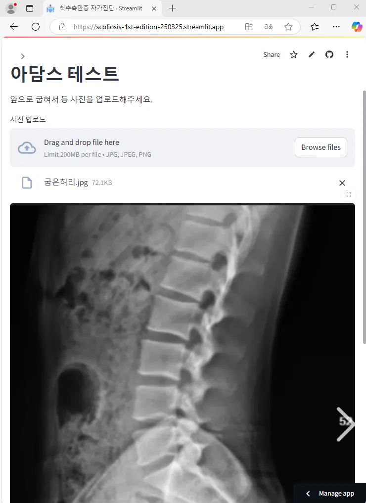 한국 X -Ray의 이미지
