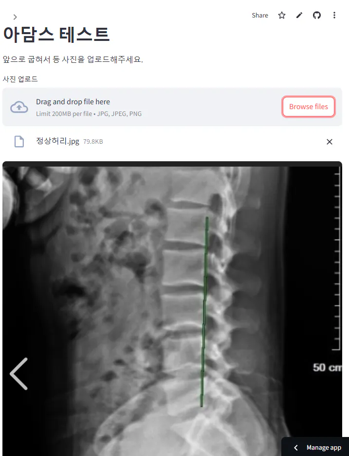 사람의 척추의 X- 광선의 이미지