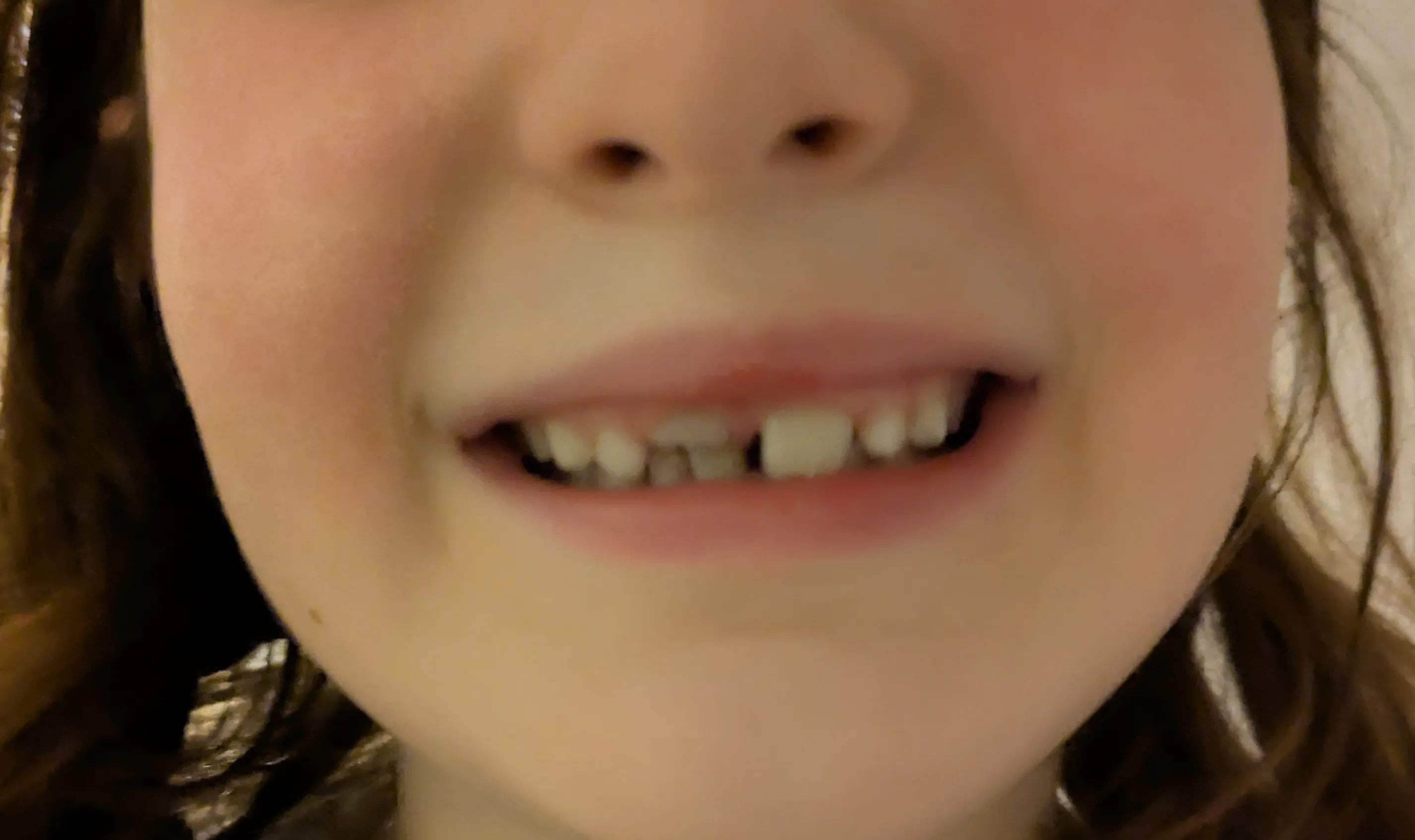 Teeth