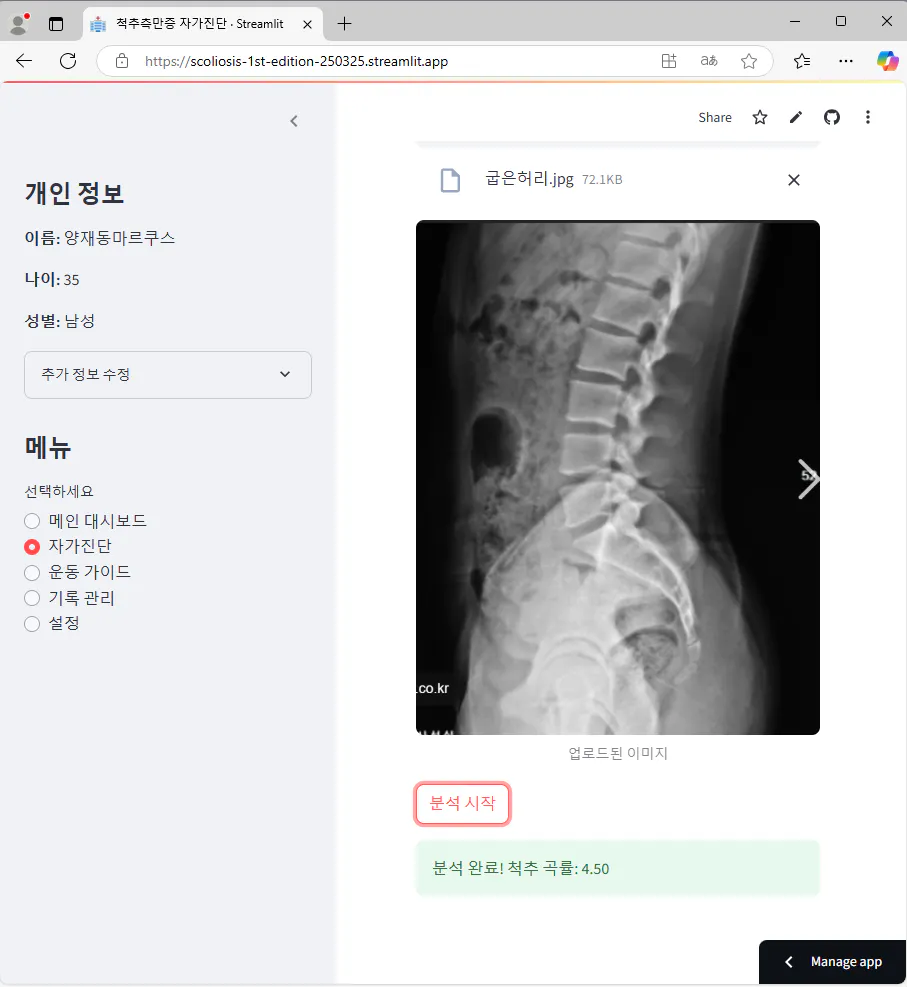 한국어 X -Ray의 이미지