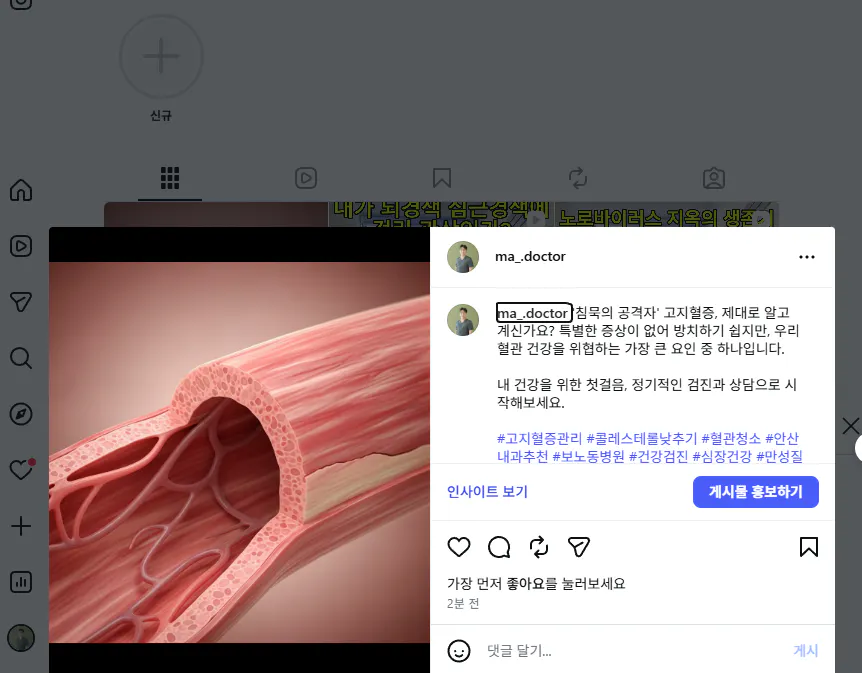 혈관 사진을 보여주는 한국 페이스북 페이지의 스크린샷